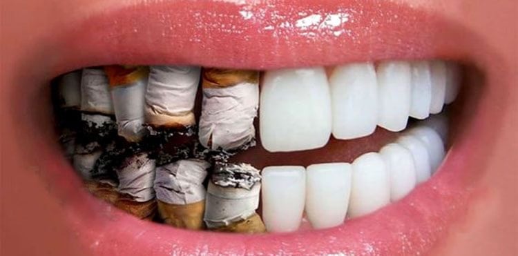 Smoking-Tobacco-Oral-Health